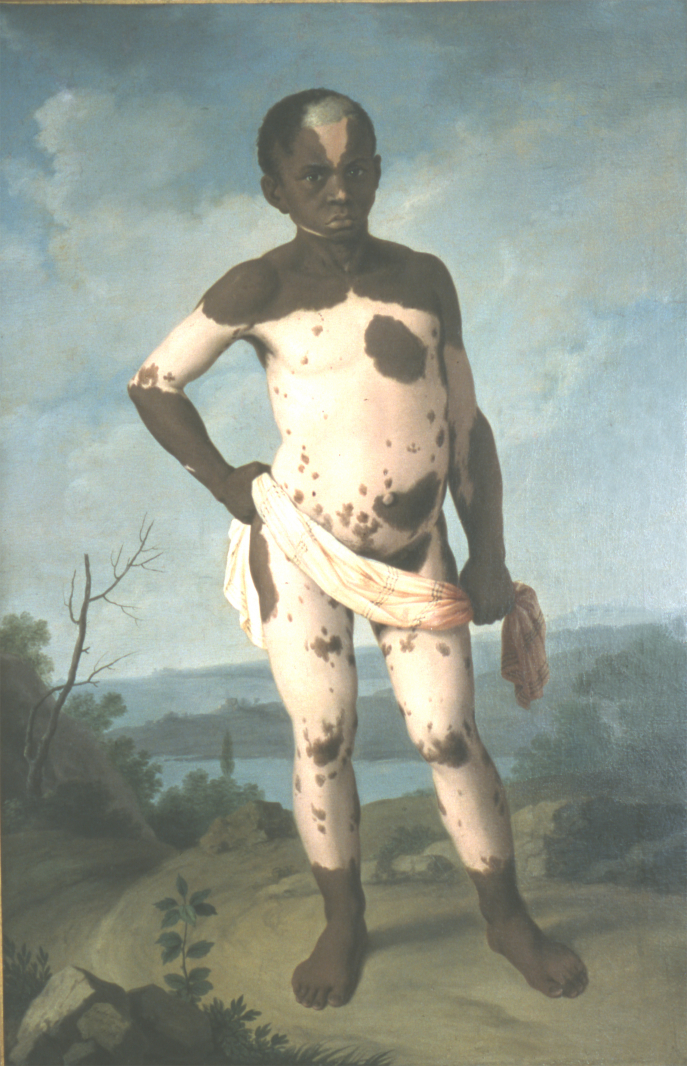 Anonyme, Siriaco, huile sur toile, 1786, Paris, Faculté de médecine Anonyme, Siriaco, huile sur toile, 1786, Paris, Faculté de médecine